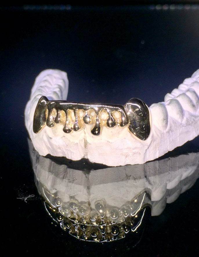 6 Teeth Gold Grillz - 6 Bottoms (Drip Effect) - Norma's Jewelry