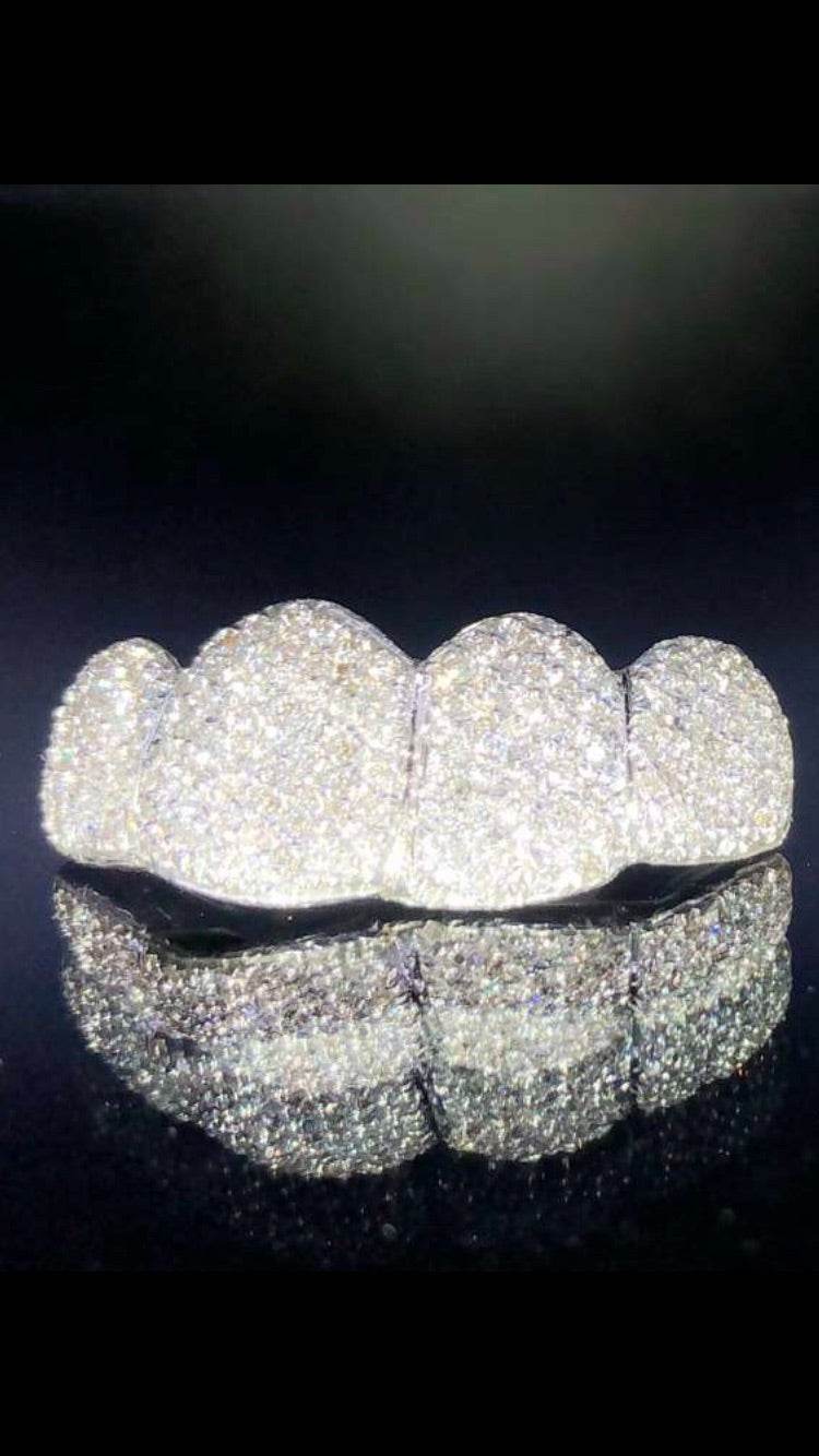 4 Teeth Diamond Grillz - 4 Tops (Micro Pave) - Norma's Jewelry