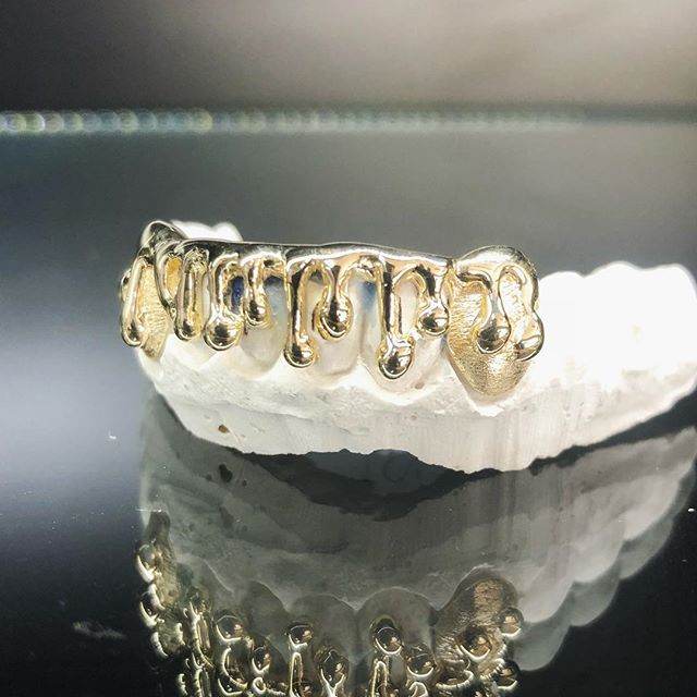 6 Teeth Gold Grillz - 6 Bottoms (Open Face Drip) - Norma's Jewelry