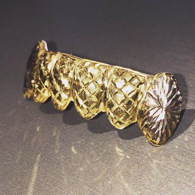 6 Teeth Gold Grillz - 6 Tops (Trillion Cuts w/ Starburst Fangs) - Norma's Jewelry