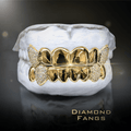 14 Teeth Diamond Grillz - 6 Tops & 8 Bottoms (Gold w/ Diamond Fangs) - Norma's Jewelry