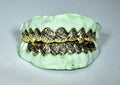 20 Teeth Gold Grillz - 10 Tops/Bottoms (Diamond Cuts) - Norma's Jewelry