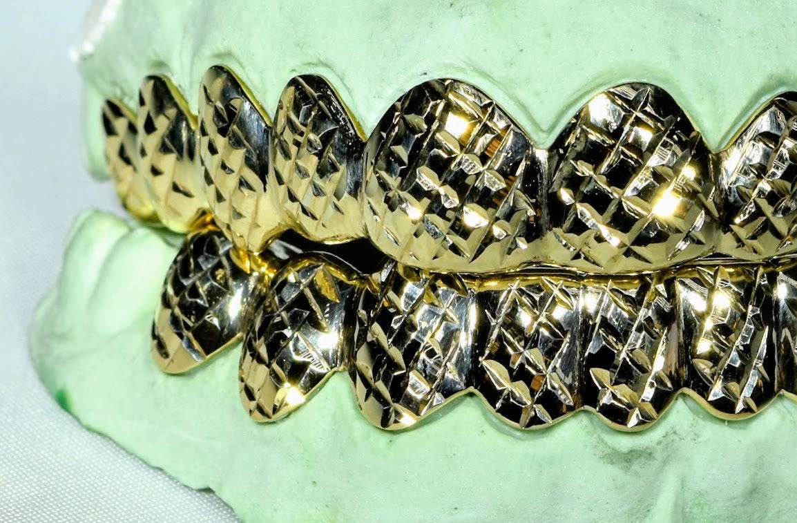 20 Teeth Gold Grillz - 10 Tops/Bottoms (Diamond Cuts) - Norma's Jewelry