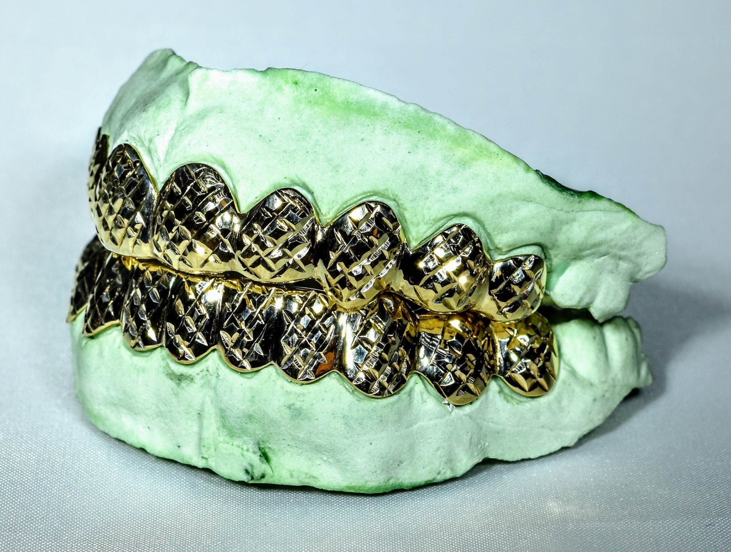 20 Teeth Gold Grillz - 10 Tops/Bottoms (Diamond Cuts) - Norma's Jewelry