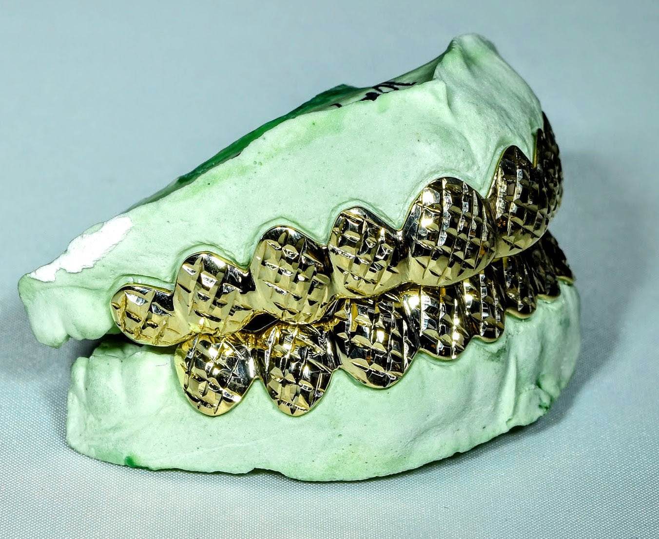 20 Teeth Gold Grillz - 10 Tops/Bottoms (Diamond Cuts) - Norma's Jewelry