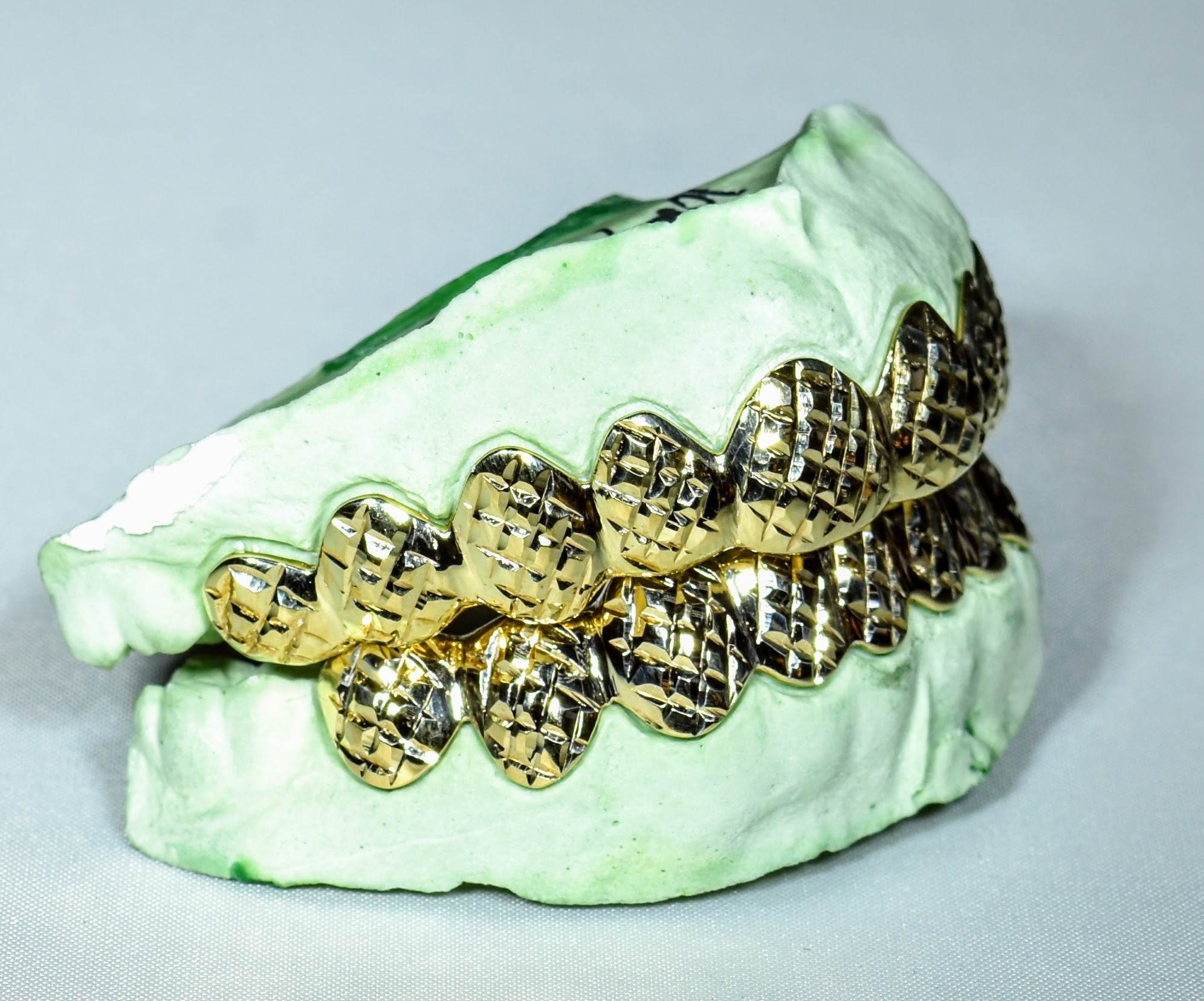 20 Teeth Gold Grillz - 10 Tops/Bottoms (Diamond Cuts) - Norma's Jewelry
