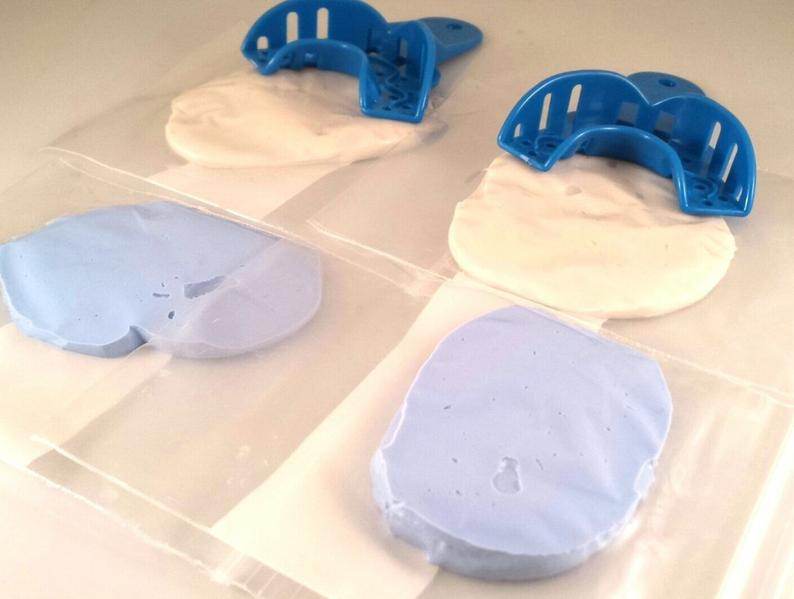 Professional Dental Mold Kit - Shipped to you! - Norma's Jewelry