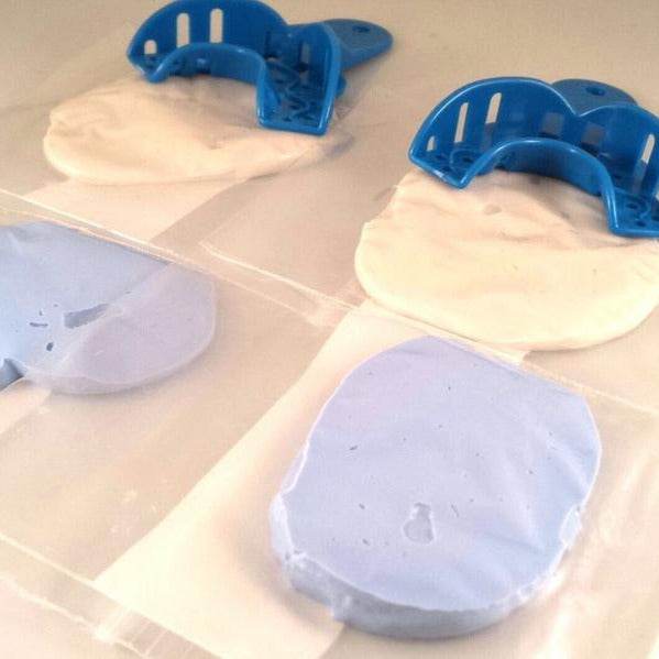 Professional Dental Mold Kit - Shipped to you! - Norma's Jewelry