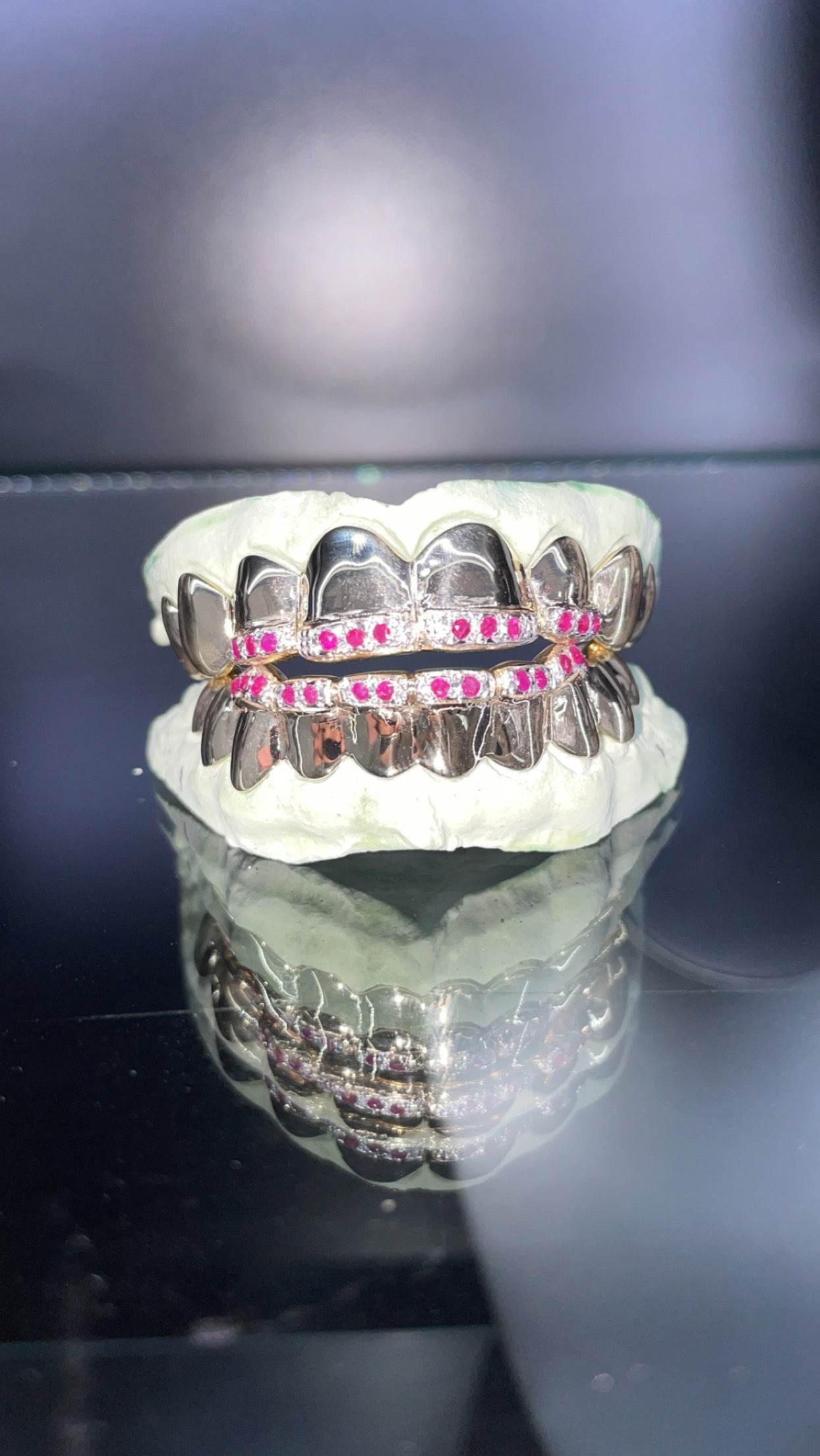 18 Teeth Gold Grillz - 8 Tops & 10 Bottoms (Nugget w/ Diamonds Tip Fangs) - Norma's Jewelry
