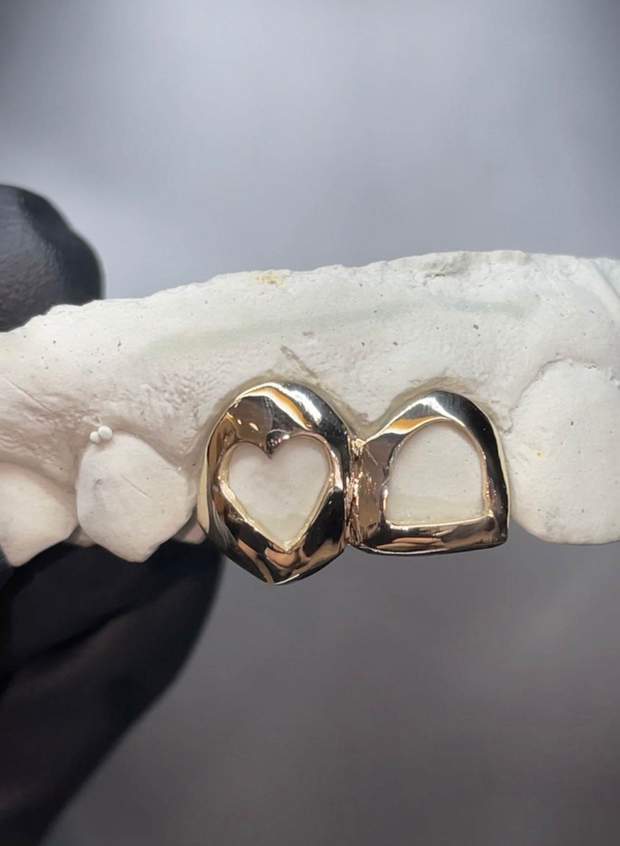 Gold Open Face Heart Grillz - Norma's Jewelry