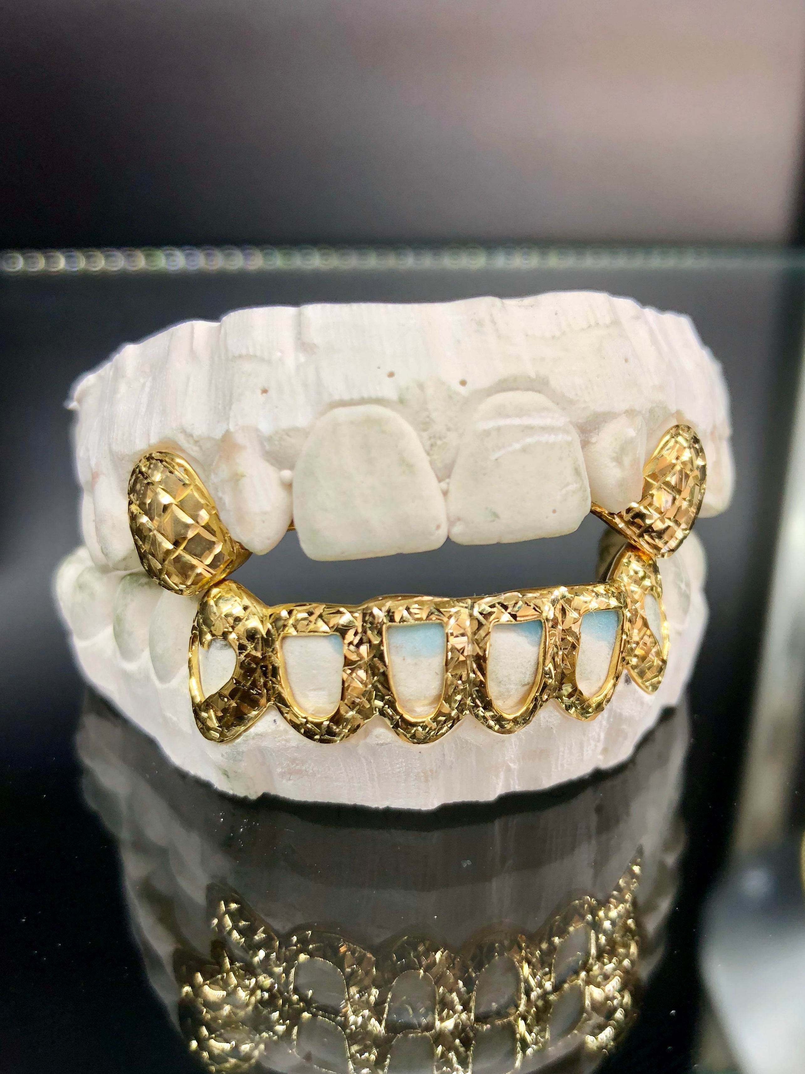 8 Teeth Gold Grillz - 2 Tops & 6 Bottoms (Open Face w/ Back Bridge) - Norma's Jewelry