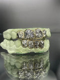 8 Teeth Gold Grillz - 4 Tops/Bottoms (Starburst) - Norma's Jewelry