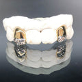 2 Teeth Gold Grillz (White Gold Diamond Cut w/ Back Bridge) - Norma's Jewelry