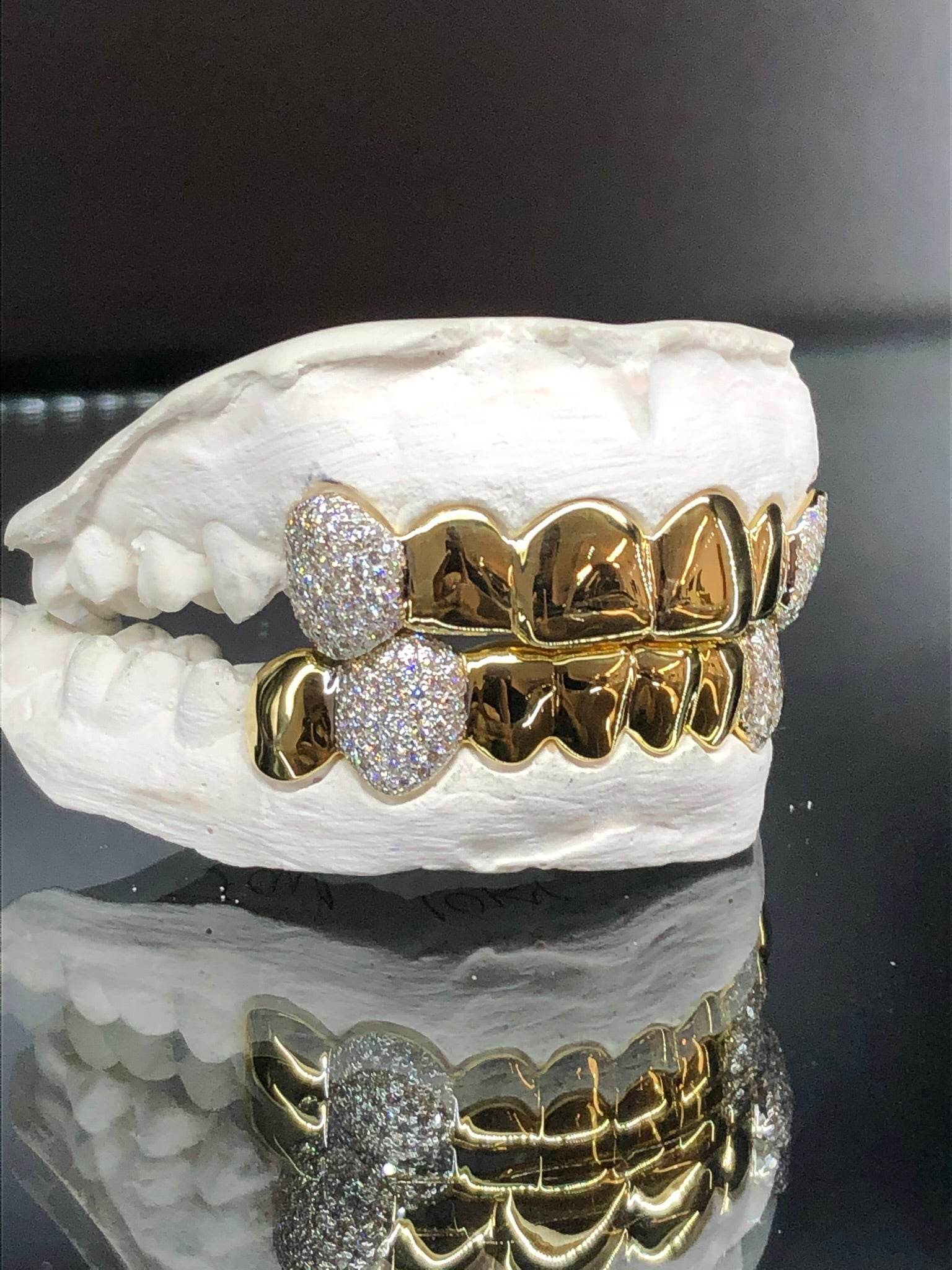 14 Teeth Diamond Grillz - 6 Tops & 8 Bottoms (Gold w/ Diamond Fangs) - Norma's Jewelry